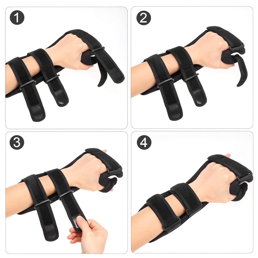 AO法骨折治療hand and wrist Amazon.co.jp: AO法骨折治療 Hand (AOTRAUMA) : 田中 正: 本